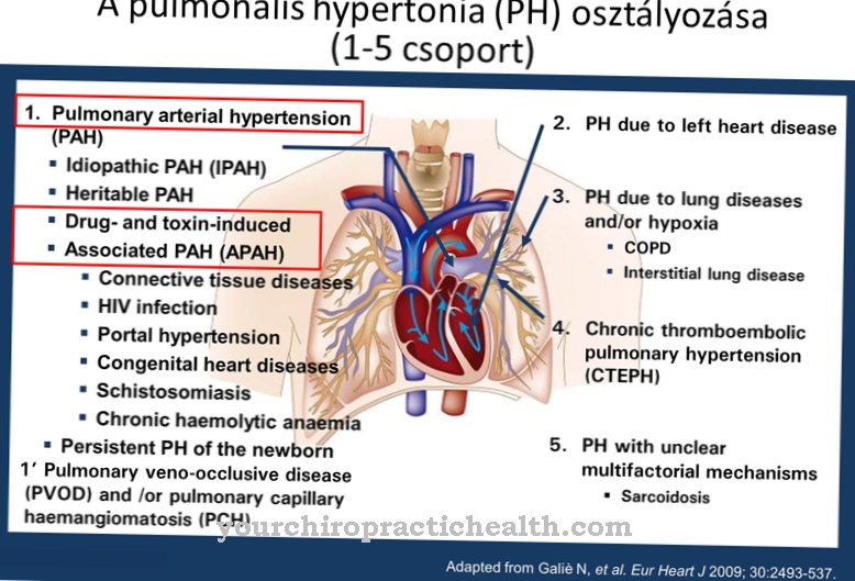 Anatómia - Tüdő artéria