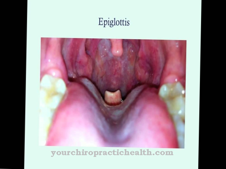 epiglotis