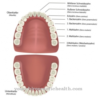 zubná protéza
