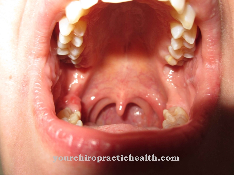 Oral mucosa