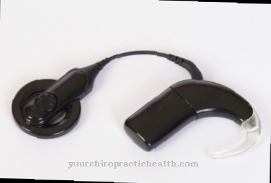 Cochlear implantaat