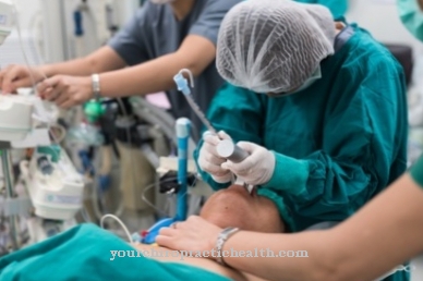 Endotracheal intubation