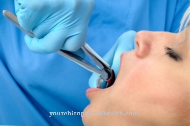 Uuttaminen (hammaslääketiede)