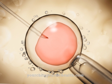 Ενδοκυτταροπλασματική ένεση σπέρματος