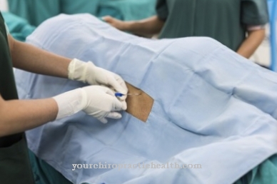 Conduction anesthesia