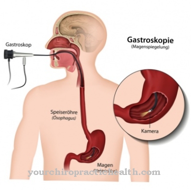 Gastroscopy