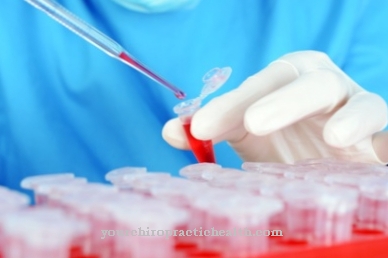 Transplantácia kmeňových buniek