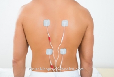 Transkutánna elektrická nervová stimulácia