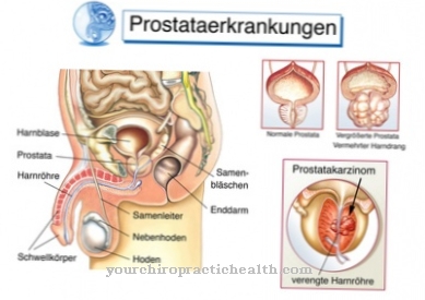 Transurethral prostate resection