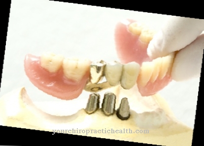 zobu protēzes