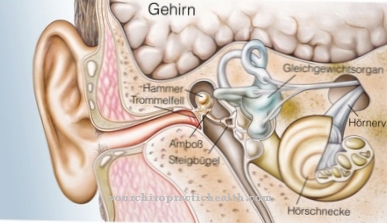 Ακουστικό νεύρωμα (νευρίωμα)
