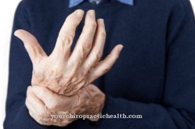 Võõraste käte sündroom