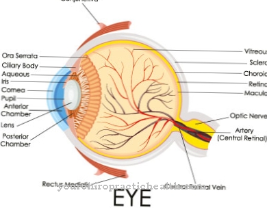 Neuropathie optique ischémique antérieure