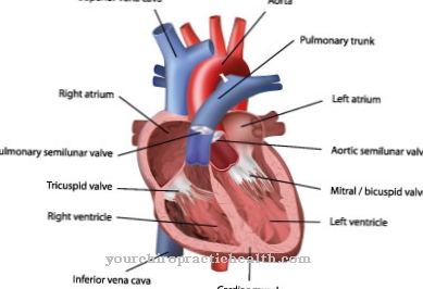 Koartacija aorte
