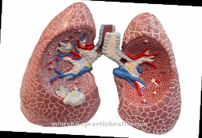 Zachłystowe zapalenie płuc