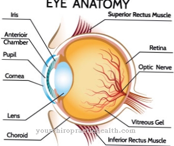 Astigmatism (curvature of the cornea)