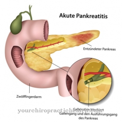 Inflammation du pancréas (pancréatite)