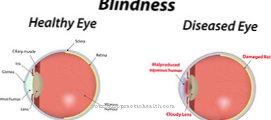 слепота