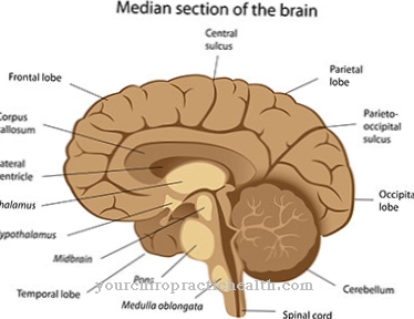 Синдром на булбарния мозък
