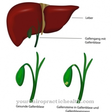 Colangitis (inflamación del conducto biliar)