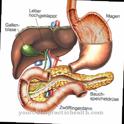 Common bile duct cyst