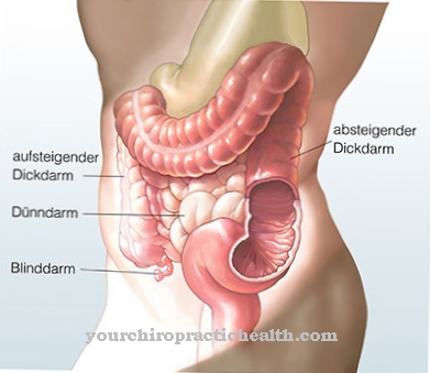 Pseudo-obstruction intestinale chronique