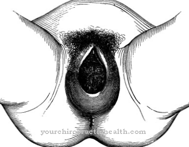 Lacerazione perineale