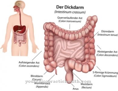 Colon inflammation