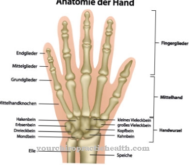 Тристранен синдром на полисиндактилия на палец