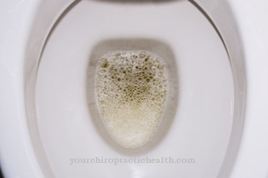 Protein in the urine (proteinuria)