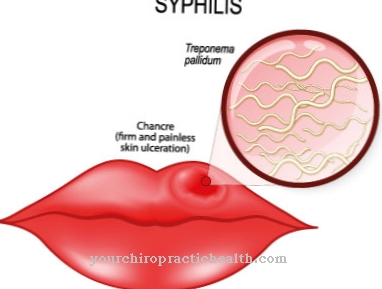 Endemický syfilis