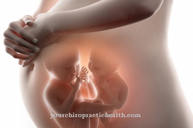 Σύνδρομο μετάγγισης εμβρύου