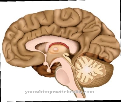متلازمة الدماغ الجبهي