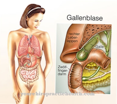 Gallbladder inflammation