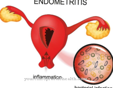 Uterine inflammation
