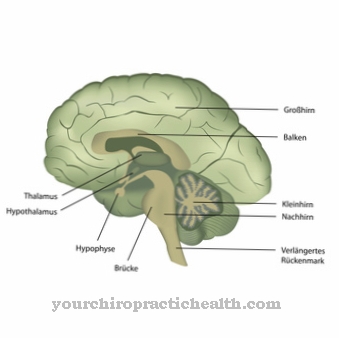 Inflammation of the brain (encephalitis)