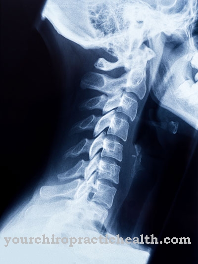 Cervical spine fracture