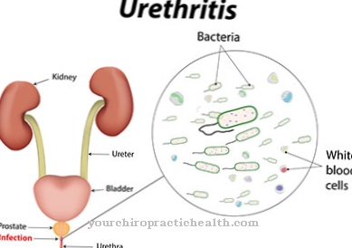 การอักเสบของท่อปัสสาวะ (urethritis)