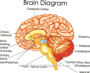 Brain edema