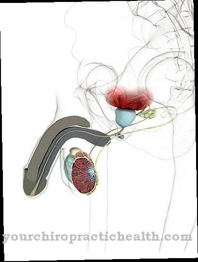 Testicular torsion (twisting of the testicle)