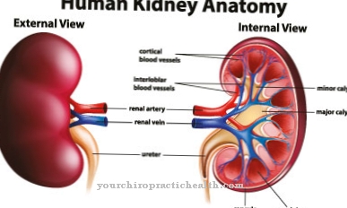 Horseshoe kidney