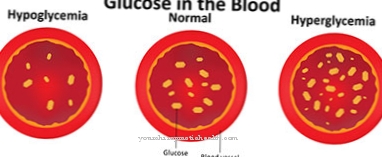 ارتفاع السكر في الدم