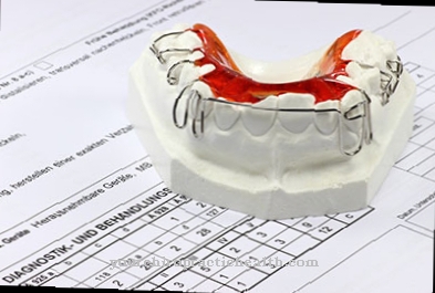 Žandikaulio pakreipimas (danties pakreipimas)