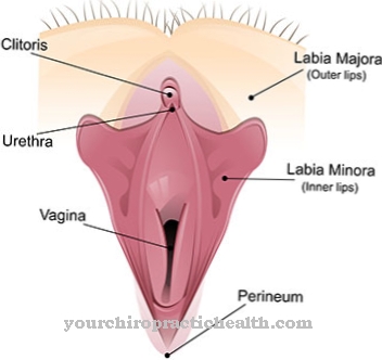 Hipertrofia clitoriana