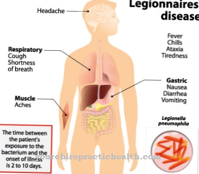 Legionnaires 'disease (legionnaires' disease)