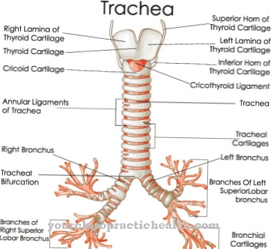 Inflammation of the trachea