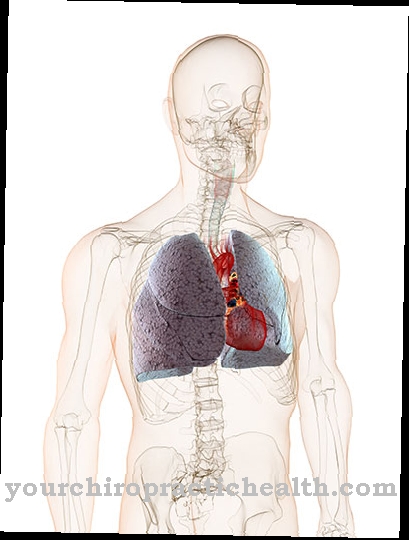 Pulmonary edema