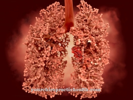Καρκίνος του πνεύμονα
