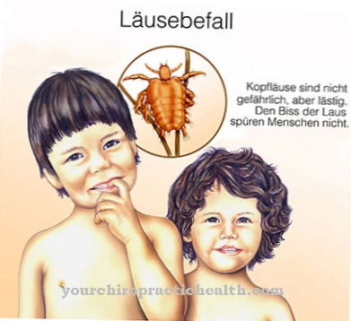 Lice infestation (pediculosis)