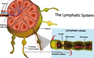 Lymphangiome